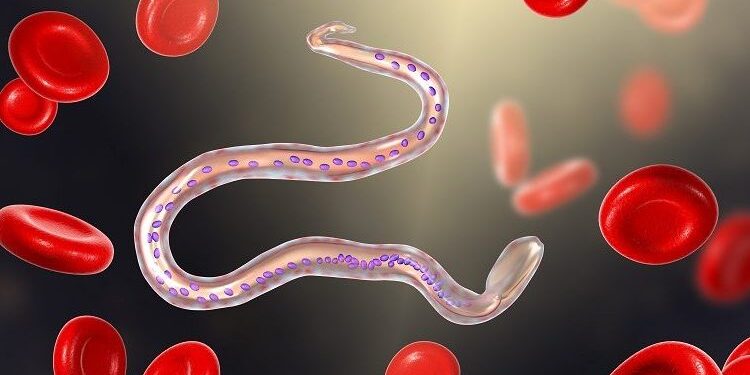 lymphatic-filariasis-e1572352433556-750×395 (1)