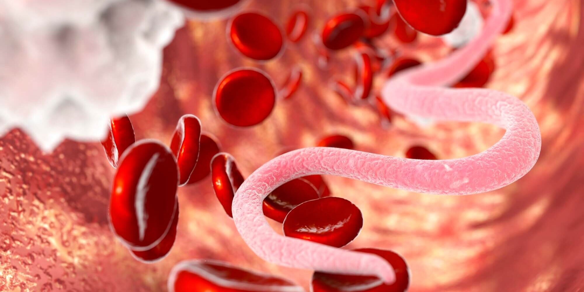 microfilariawormsbloodg6850_1515281