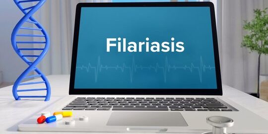 360_F_334290913_H4DzReQUdUMQ6QiR0sg965wUUMKAAf2H